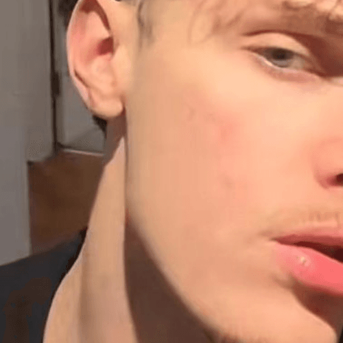 After transformation 1