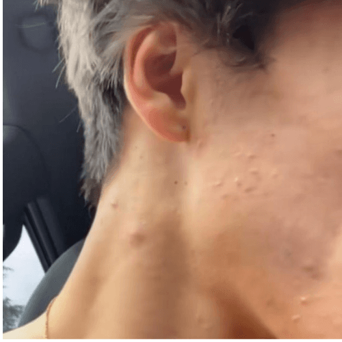 Before transformation 2