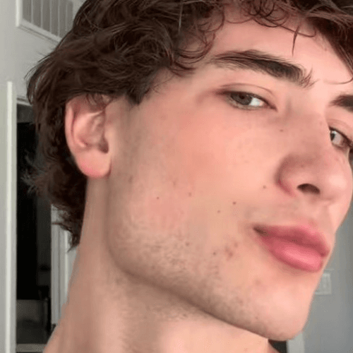 Before transformation 3